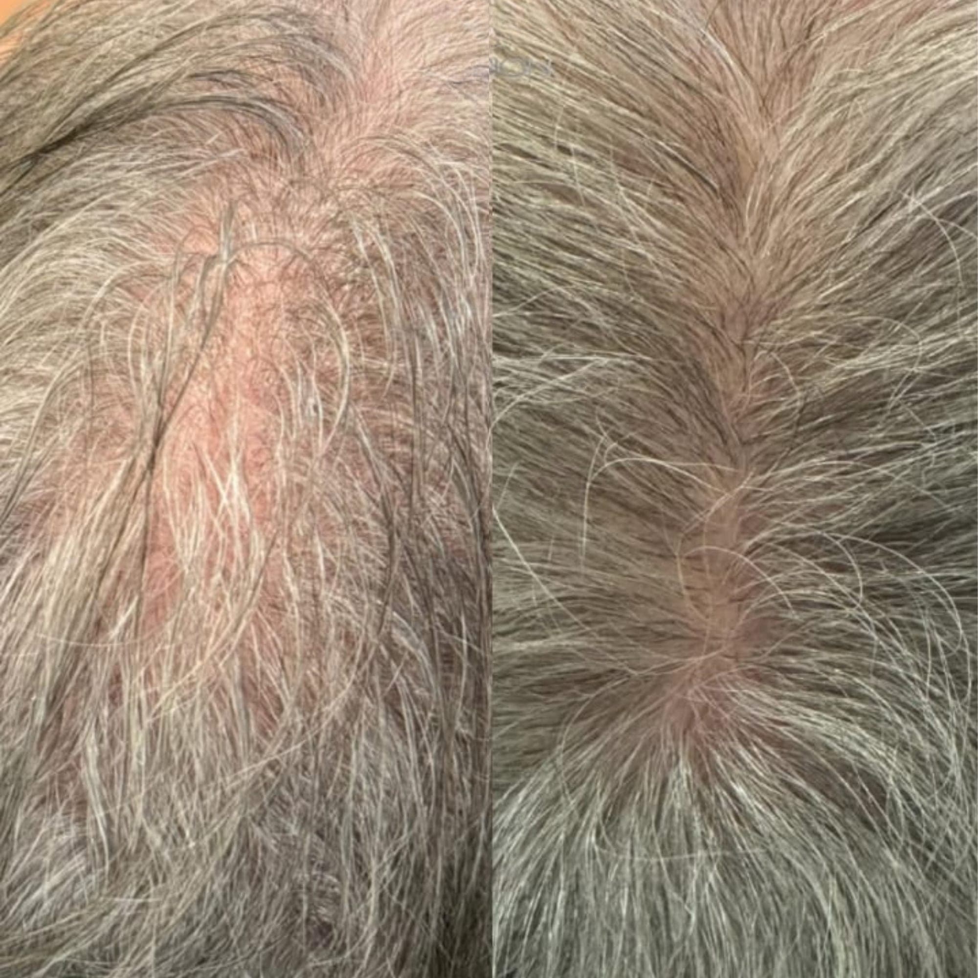 Real client before and after result at Hope Aesthetics