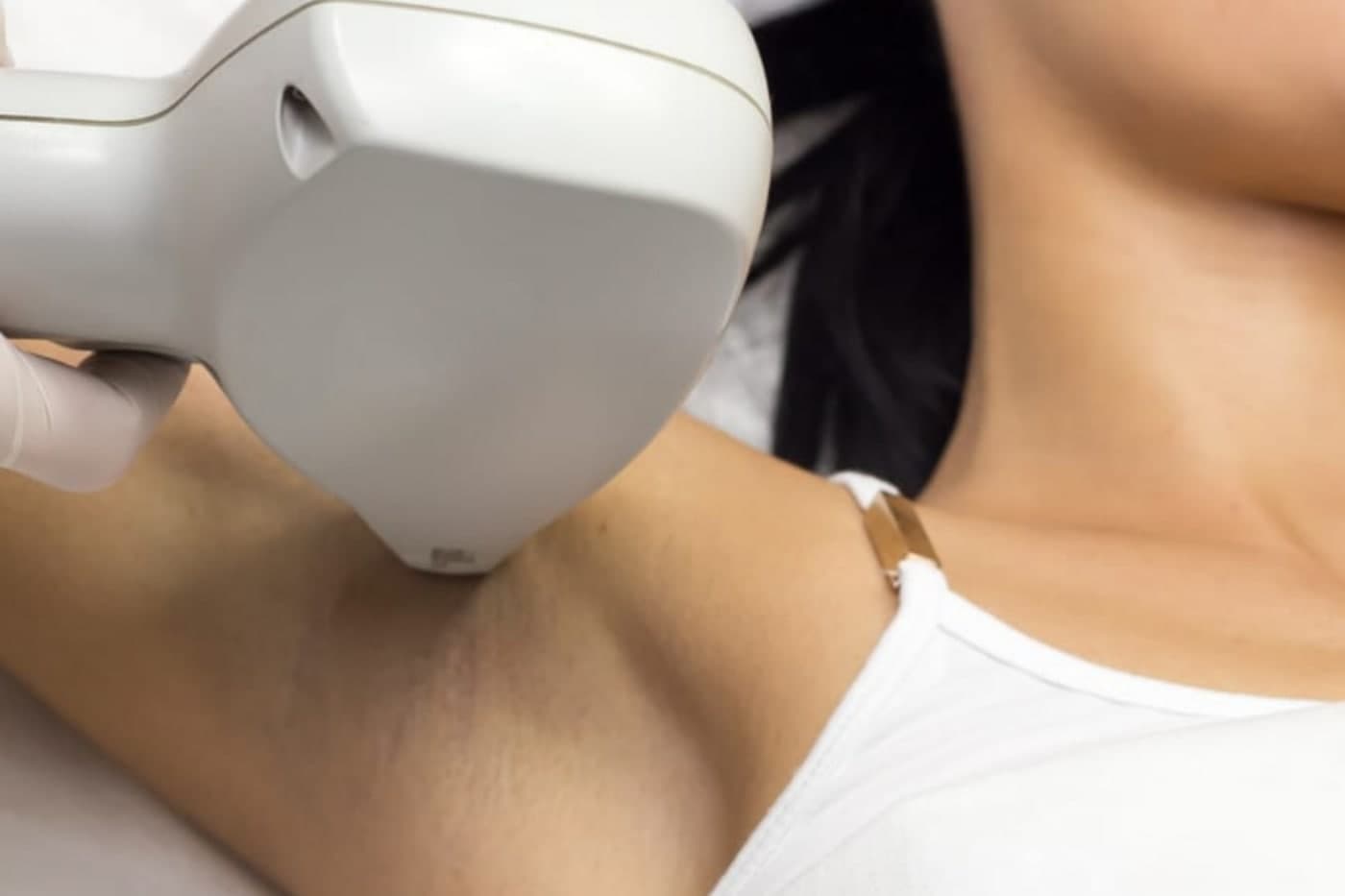 IPL & Nd:YAG Laser at Hope Aesthetics
